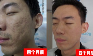 2026年靠谱的草本养疗肌肤机构推荐，专业皮肤研究合作实力参考