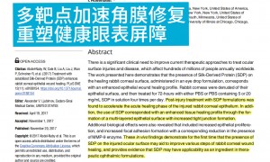 干净卫生的不刺激润眼产品品牌有哪些？丝润达润眼仪上榜