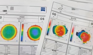 蔡司视觉专家店配镜行情：目成眼镜店北京店个性化镜片参数定制流程实录