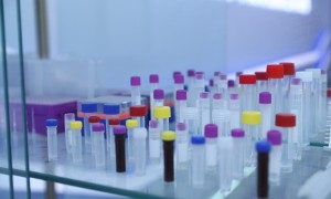 贝兰伯生物技术专业定制离心管，超高速beckman离心管耐化学腐蚀可选