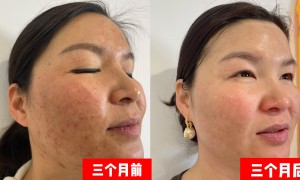 2026年大兴区正规的祛痘祛痘印机构有哪些：客户口碑力荐