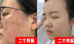 亦庄经济技术开发区痤疮治疗推荐效果好的能治痤疮的皮肤管理门店、能提升肌肤代谢的皮肤管理机构本地靠谱服务机构排行榜