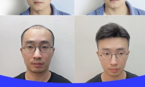 2026年靠谱的假发定制男士100%真人发中分背头假发套厂家实力参考