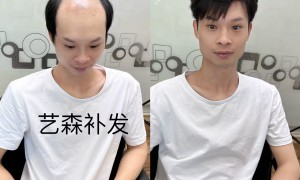 2026年正规的男士补发门店推荐，衔接自然用户力荐