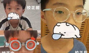 广西近视视觉训练推荐几家？靠谱机构资质与口碑测评
