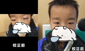 柳州本地斜弱视矫正推荐机构哪家可靠、斜弱视干预推荐机构哪家靠谱、斜弱视矫正推荐机构服务选哪家好机构筛选名录