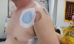辽林老式膏贴品牌怎么用、草本膏贴品牌哪里买、草本膏贴品牌测评，广受信赖的机构实力盘点